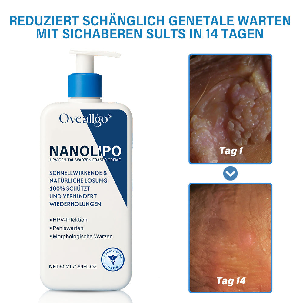 Oveallgo® NanoLipo HPV Genital warzen-Eraser creme Plus