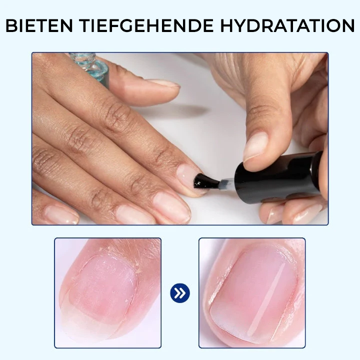 Oveallgo® OnyxoGuard Wachstum der Nägel und Reparaturserum