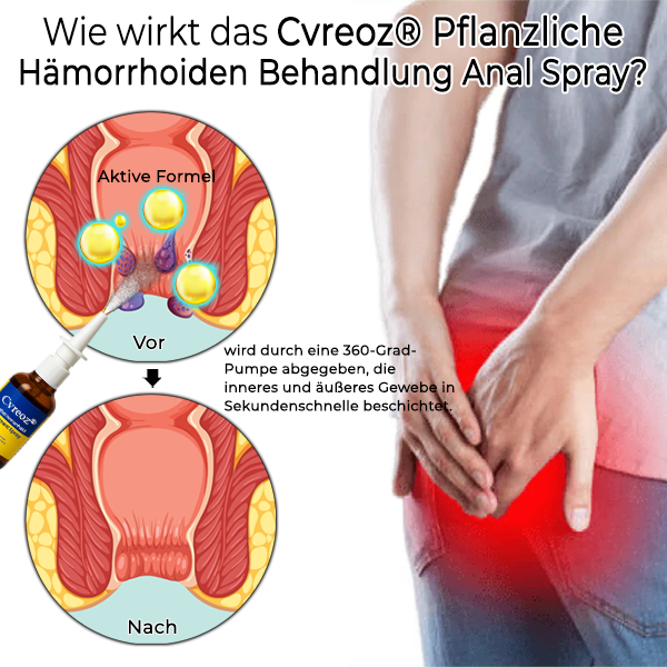 Cvreoz® Pflanzliche Hämorrhoiden Behandlung Anal Spray Pro