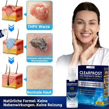 Oveallgo® ClearFrost Kälteschutz-Spray Pro