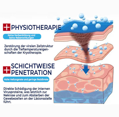 Oveallgo® ClearFrost Kälteschutz-Spray Pro