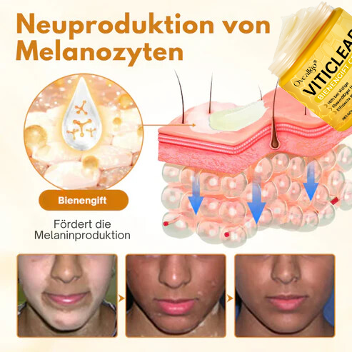 Oveallgo® VitiClear Bienengift Creme Promax