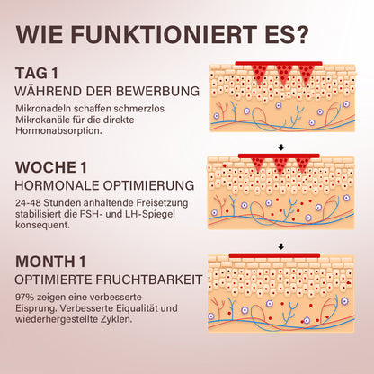 Oveallgo® FertiliPatch Mikronadel-System zur Steigerung der Fruchtbarkeit